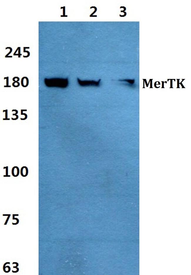 MERTK Antibody in Western Blot (WB)