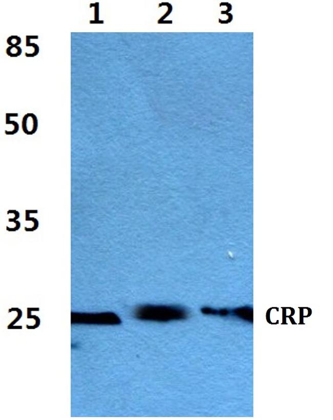 CRP Antibody in Western Blot (WB)