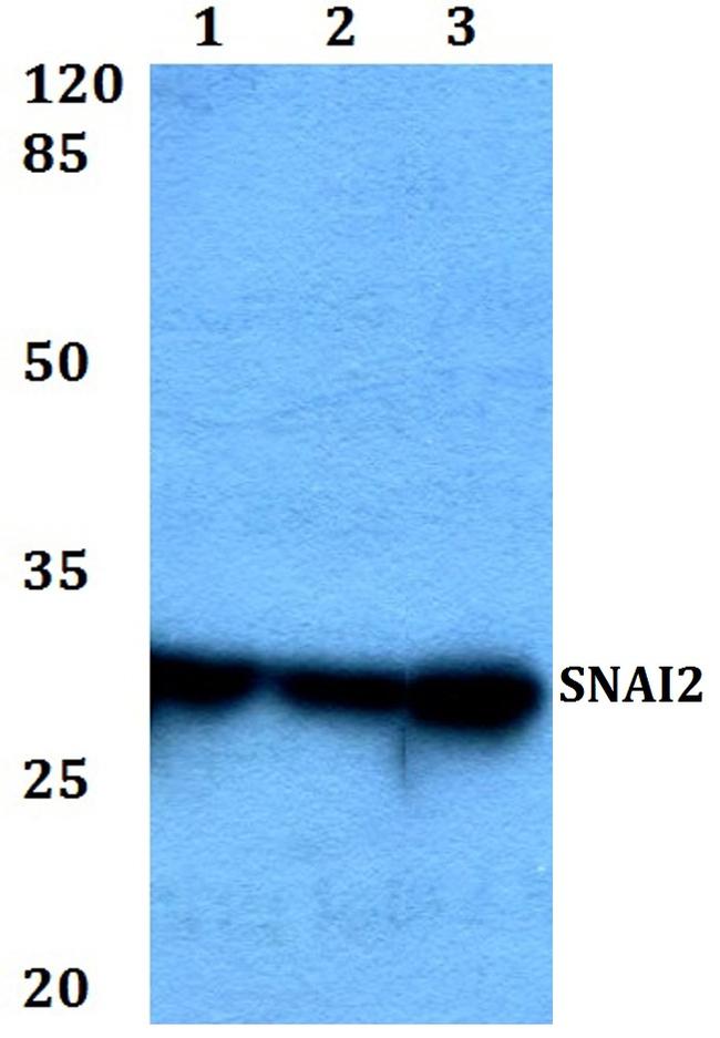 SLUG Antibody in Western Blot (WB)