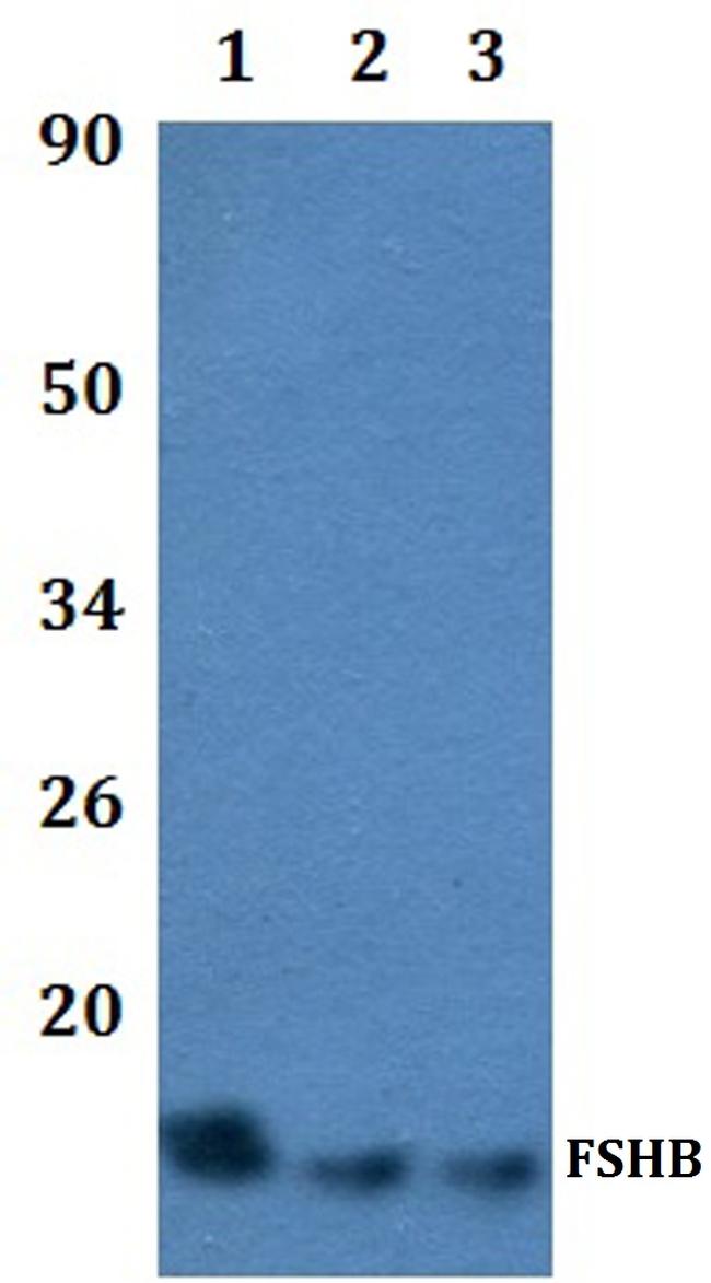 Follicle Stimulating Hormone Antibody in Western Blot (WB)