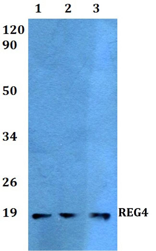 REG4 Antibody in Western Blot (WB)