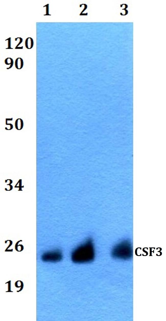 G-CSF Antibody in Western Blot (WB)