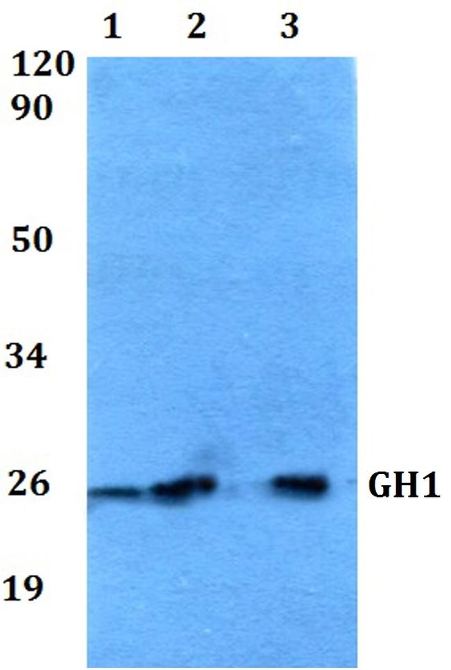 Growth Hormone Antibody in Western Blot (WB)