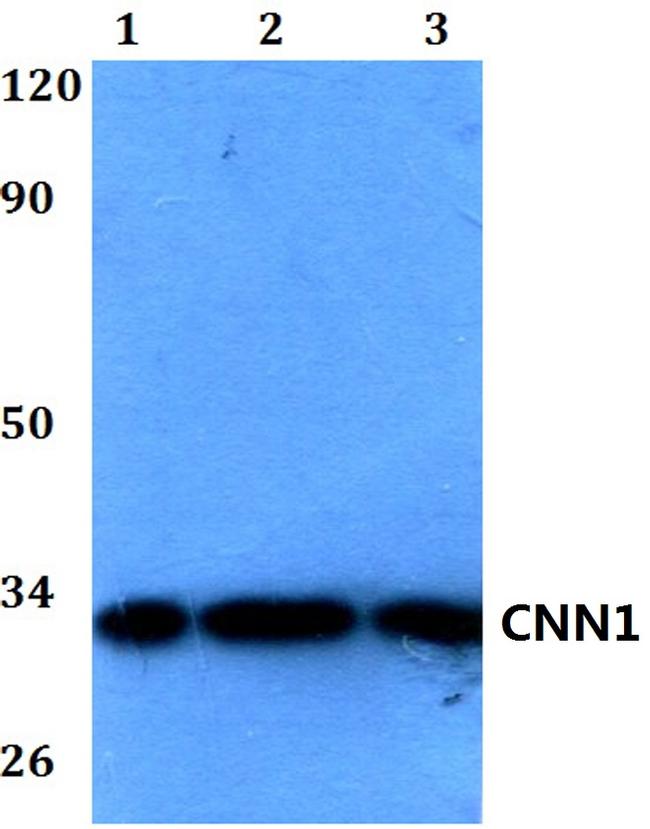 Calponin 1 Antibody in Western Blot (WB)