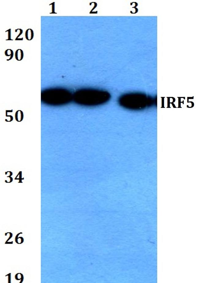 IRF5 Antibody in Western Blot (WB)