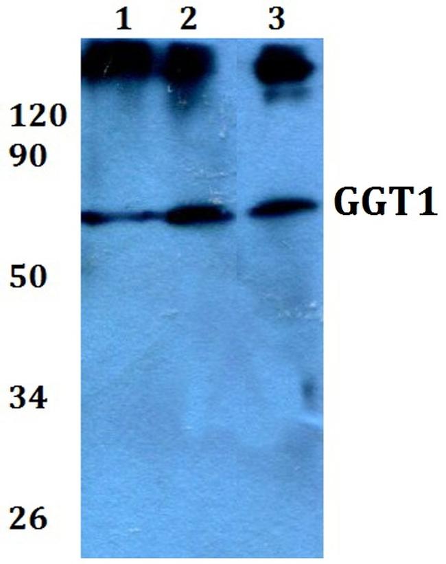 GGT1 Antibody in Western Blot (WB)