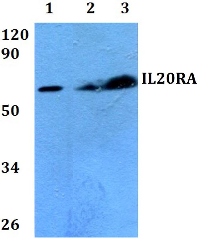 IL20RA Antibody in Western Blot (WB)