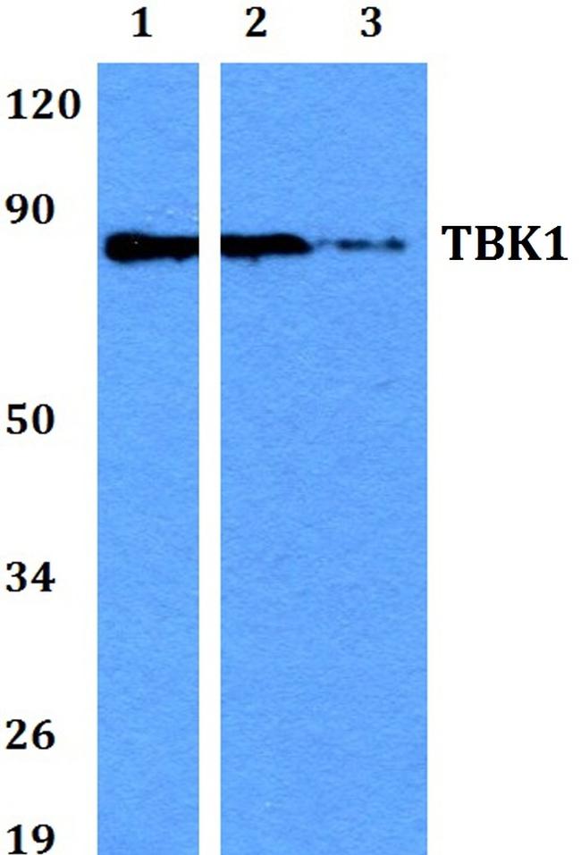 TBK1 Antibody in Western Blot (WB)