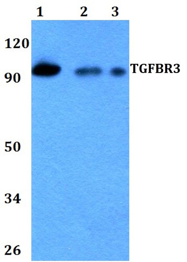 TGFBR3 Antibody in Western Blot (WB)