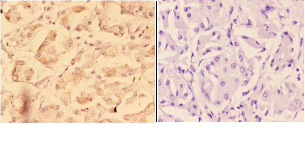 ADAM12 Antibody in Immunohistochemistry (Paraffin) (IHC (P))