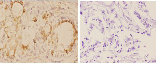 ADAM12 Antibody in Immunohistochemistry (Paraffin) (IHC (P))