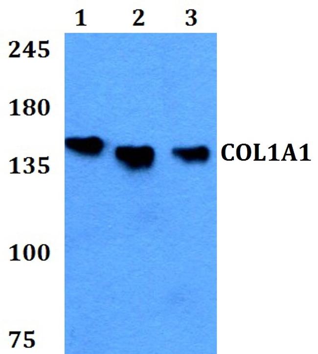 COL1A1 Antibody in Western Blot (WB)