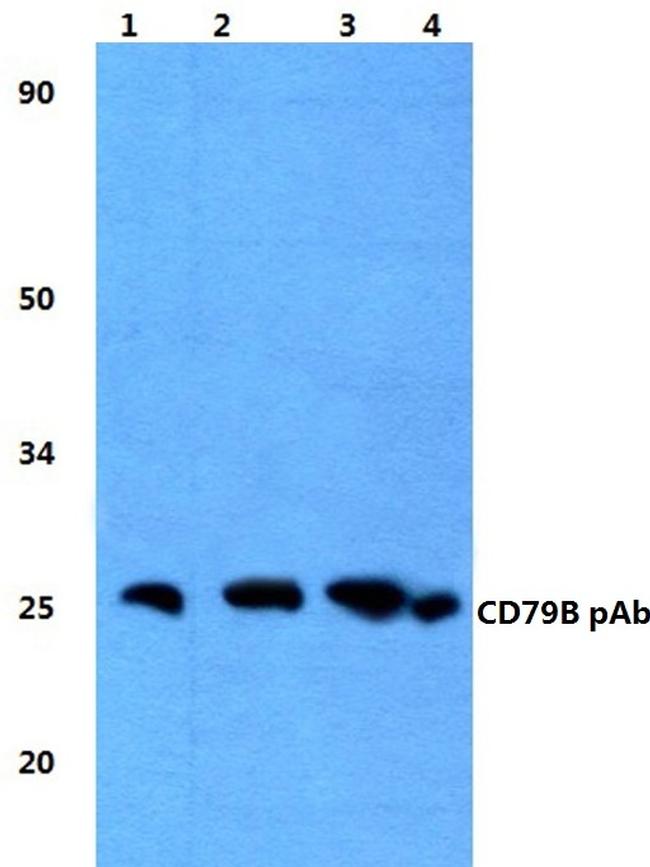 CD79b Antibody in Western Blot (WB)