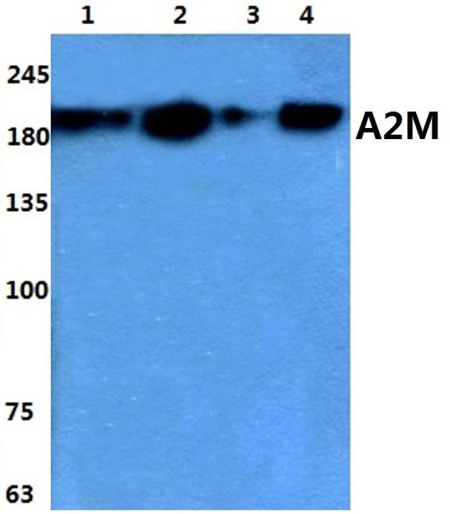 A2M Antibody in Western Blot (WB)