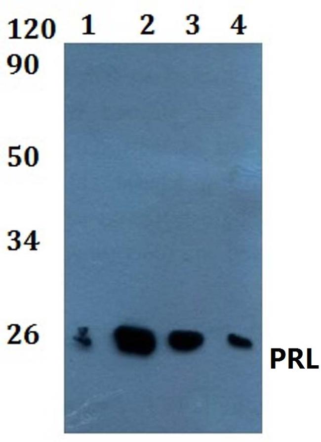 Prolactin Antibody in Western Blot (WB)