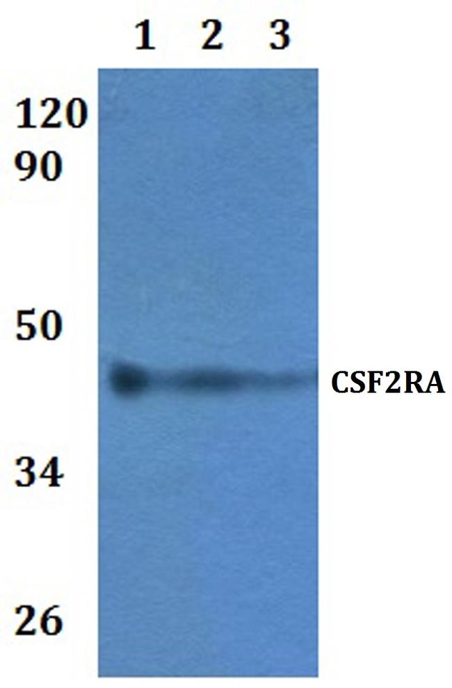 CSF2RA Antibody in Western Blot (WB)