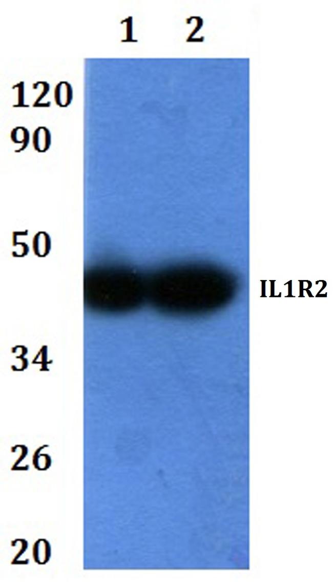 IL1R2 Antibody in Western Blot (WB)