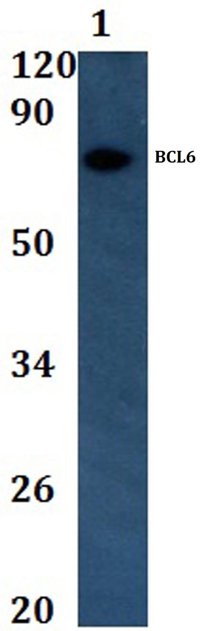 BCL6 Antibody in Western Blot (WB)