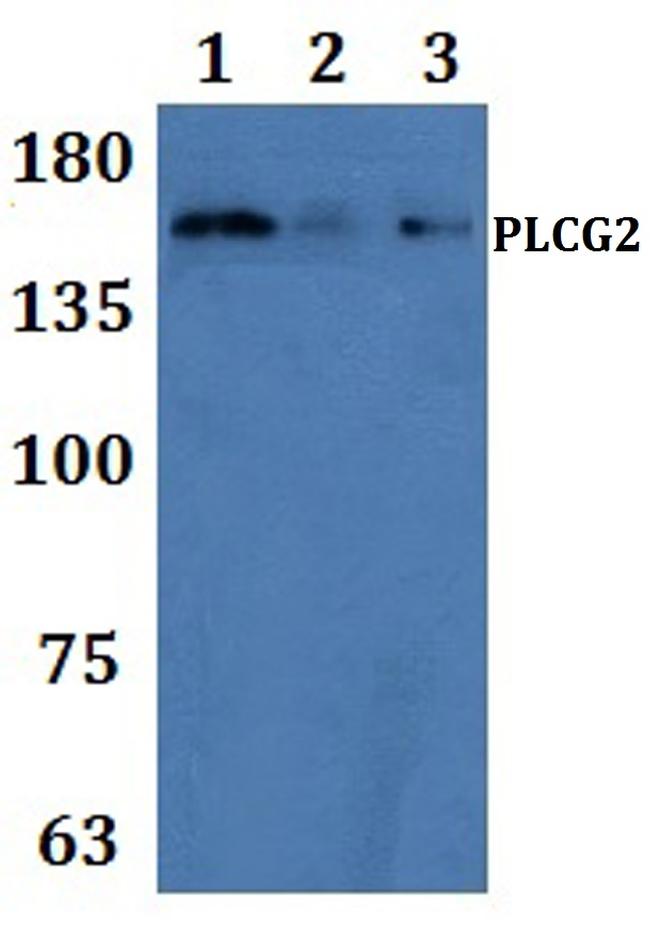 PLCG2 Antibody in Western Blot (WB)