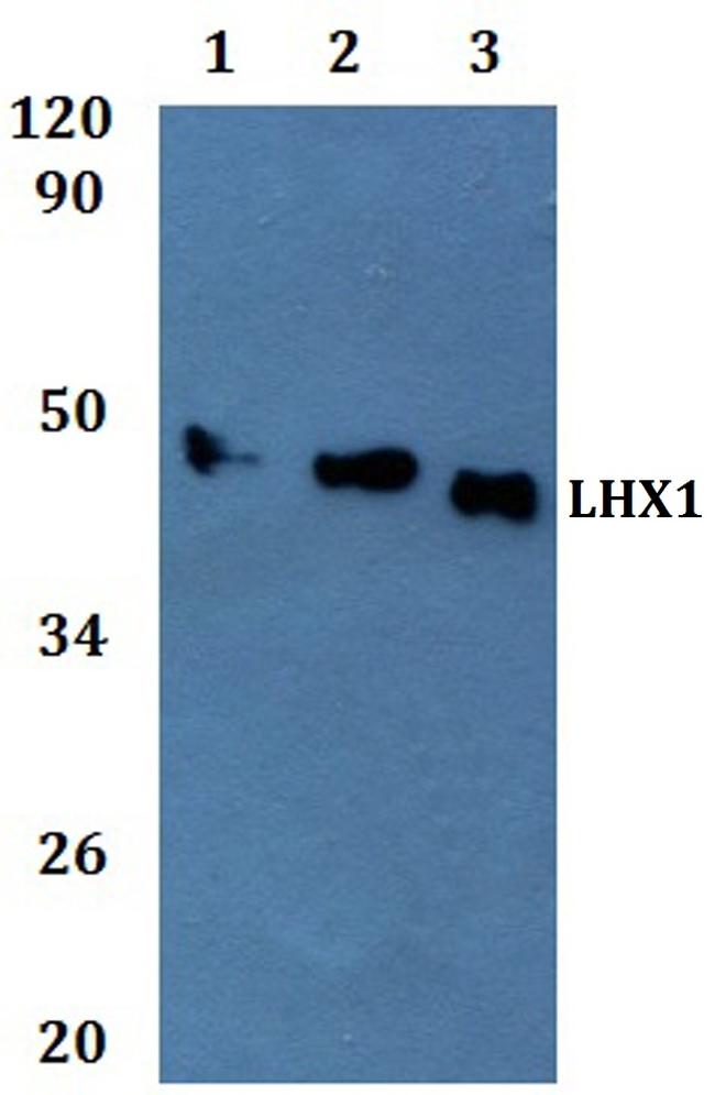 LIM1 Antibody in Western Blot (WB)