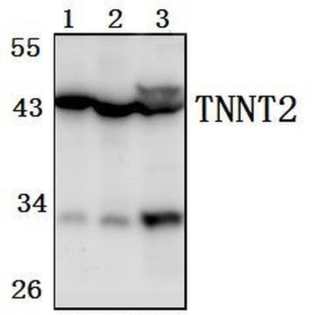 Cardiac Troponin T Antibody in Western Blot (WB)