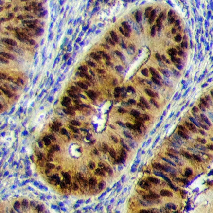 Cdc25A Antibody in Immunohistochemistry (Paraffin) (IHC (P))