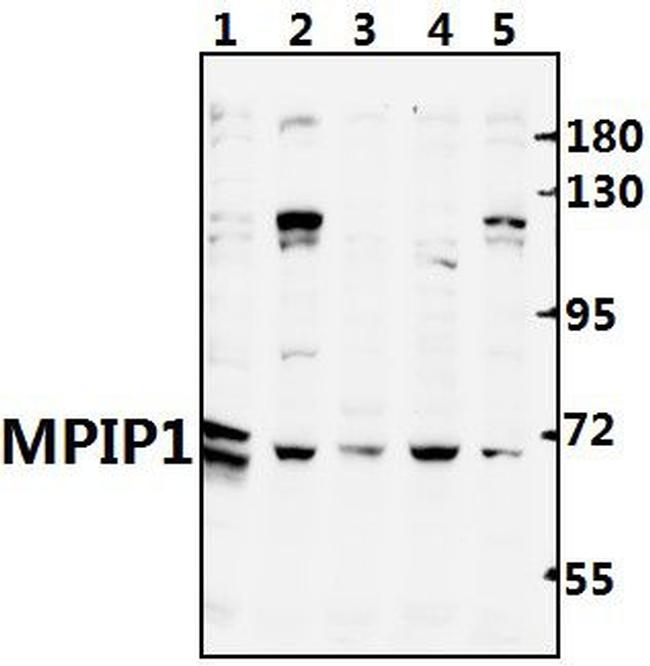 Cdc25A Antibody in Western Blot (WB)