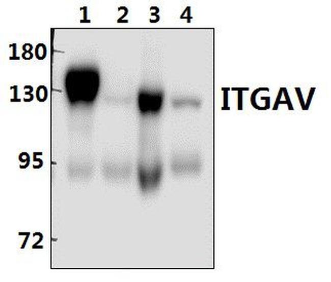 CD51 Antibody in Western Blot (WB)