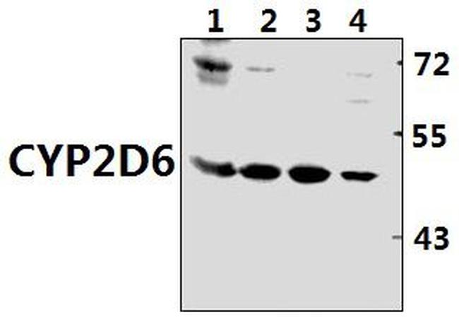 CYP2D6 Antibody in Western Blot (WB)