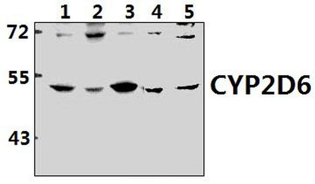 CYP2D6 Antibody in Western Blot (WB)