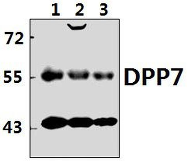 DPP2 Antibody in Western Blot (WB)