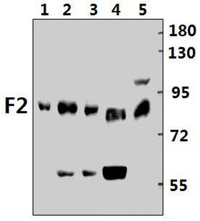 Prothrombin Antibody in Western Blot (WB)