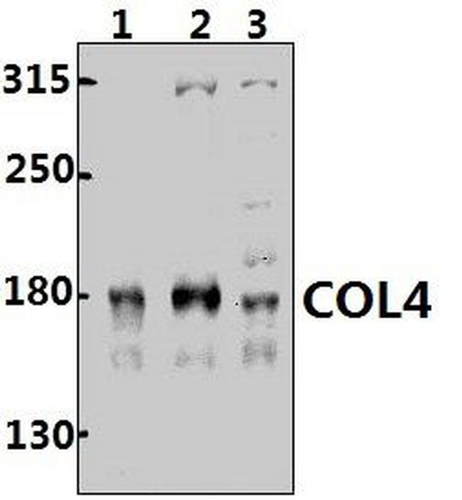 Collagen IV Antibody in Western Blot (WB)