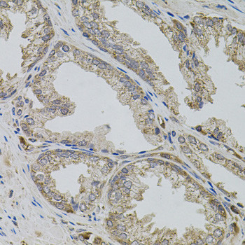 VIP Antibody in Immunohistochemistry (Paraffin) (IHC (P))