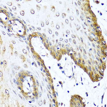 VIP Antibody in Immunohistochemistry (Paraffin) (IHC (P))