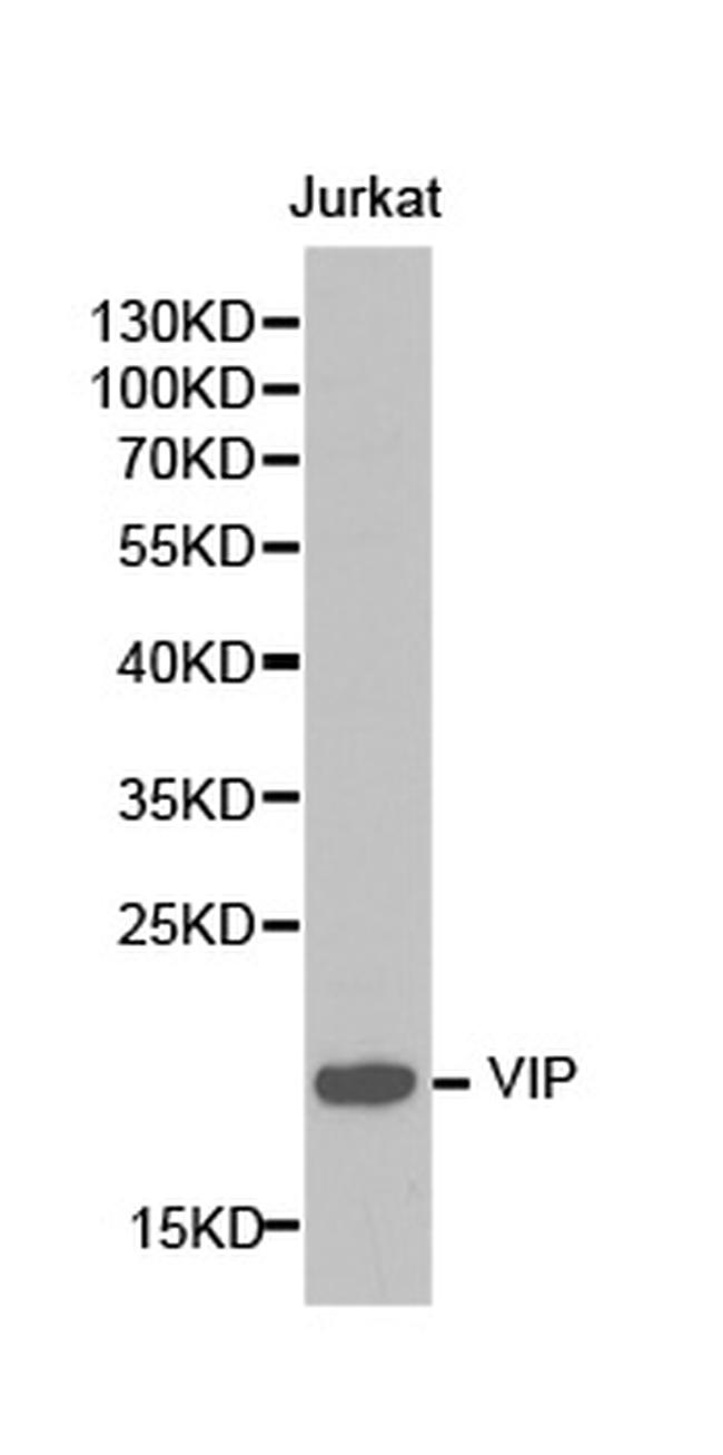 VIP Antibody in Western Blot (WB)