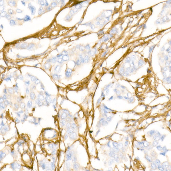 COL1A1 Antibody in Immunohistochemistry (Paraffin) (IHC (P))