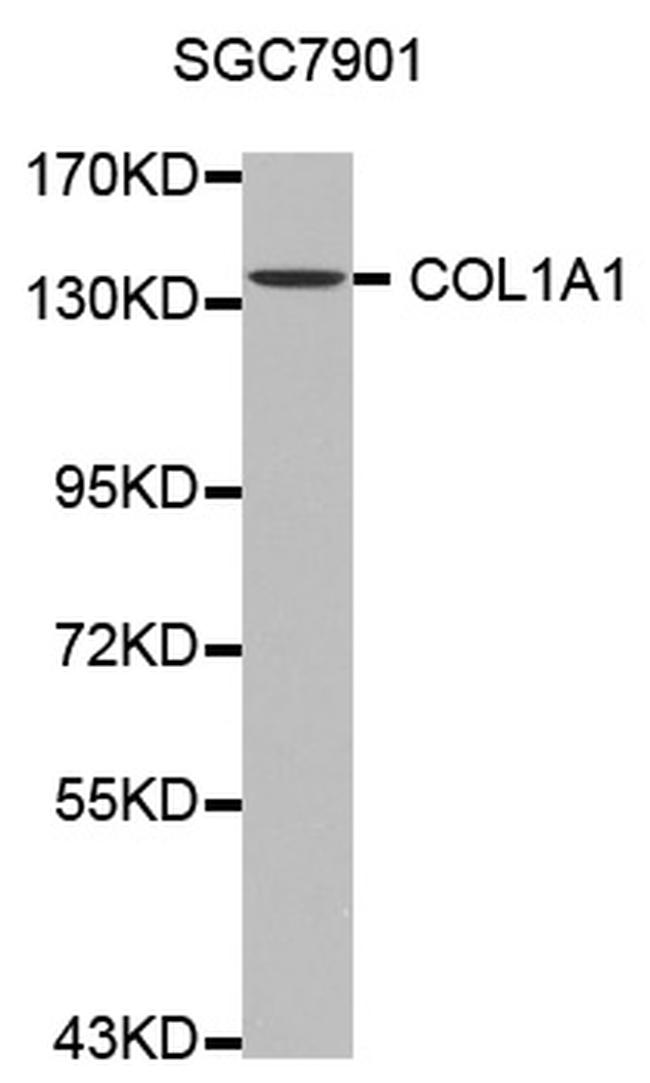 COL1A1 Antibody in Western Blot (WB)