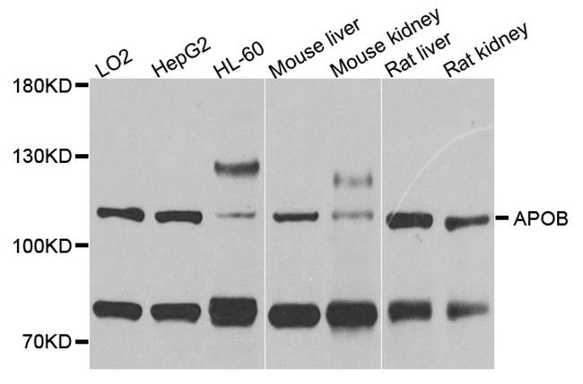 Apolipoprotein B Antibody in Western Blot (WB)