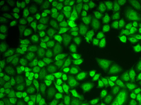 Cathepsin D Antibody in Immunocytochemistry (ICC/IF)