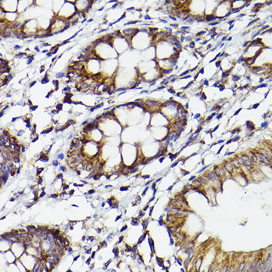 COX2 Antibody in Immunohistochemistry (Paraffin) (IHC (P))