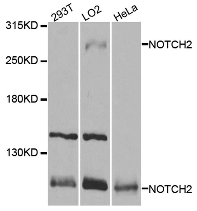 NOTCH2 Antibody in Western Blot (WB)