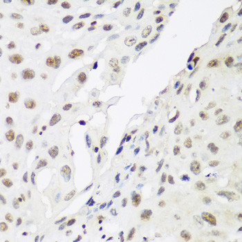 HP1 gamma Antibody in Immunohistochemistry (Paraffin) (IHC (P))