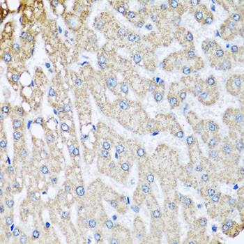 COX5B Antibody in Immunohistochemistry (Paraffin) (IHC (P))