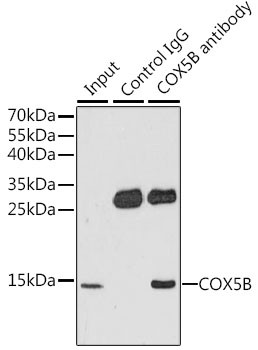 COX5B Antibody in Immunoprecipitation (IP)