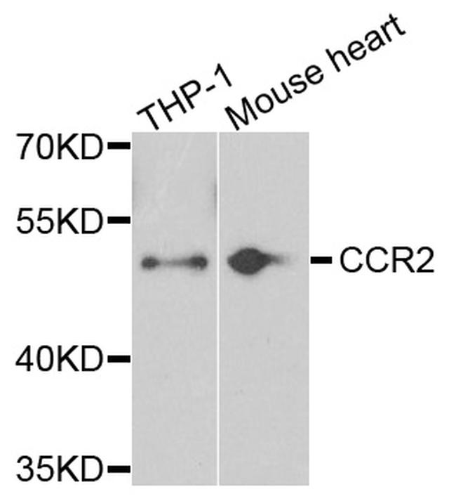 CCR2 Antibody in Western Blot (WB)