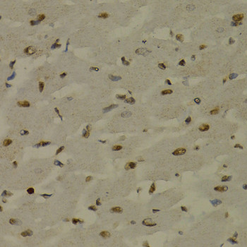 NFkB p52 Antibody in Immunohistochemistry (Paraffin) (IHC (P))