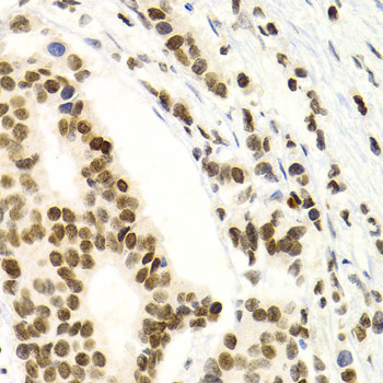 NFkB p52 Antibody in Immunohistochemistry (Paraffin) (IHC (P))