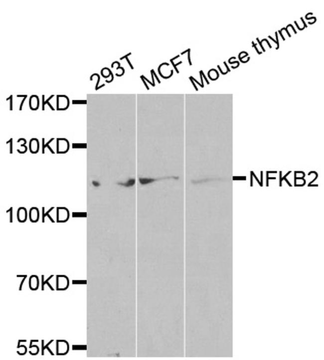 NFkB p52 Antibody in Western Blot (WB)