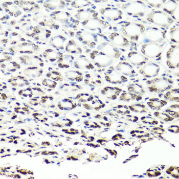 NuMA Antibody in Immunohistochemistry (Paraffin) (IHC (P))